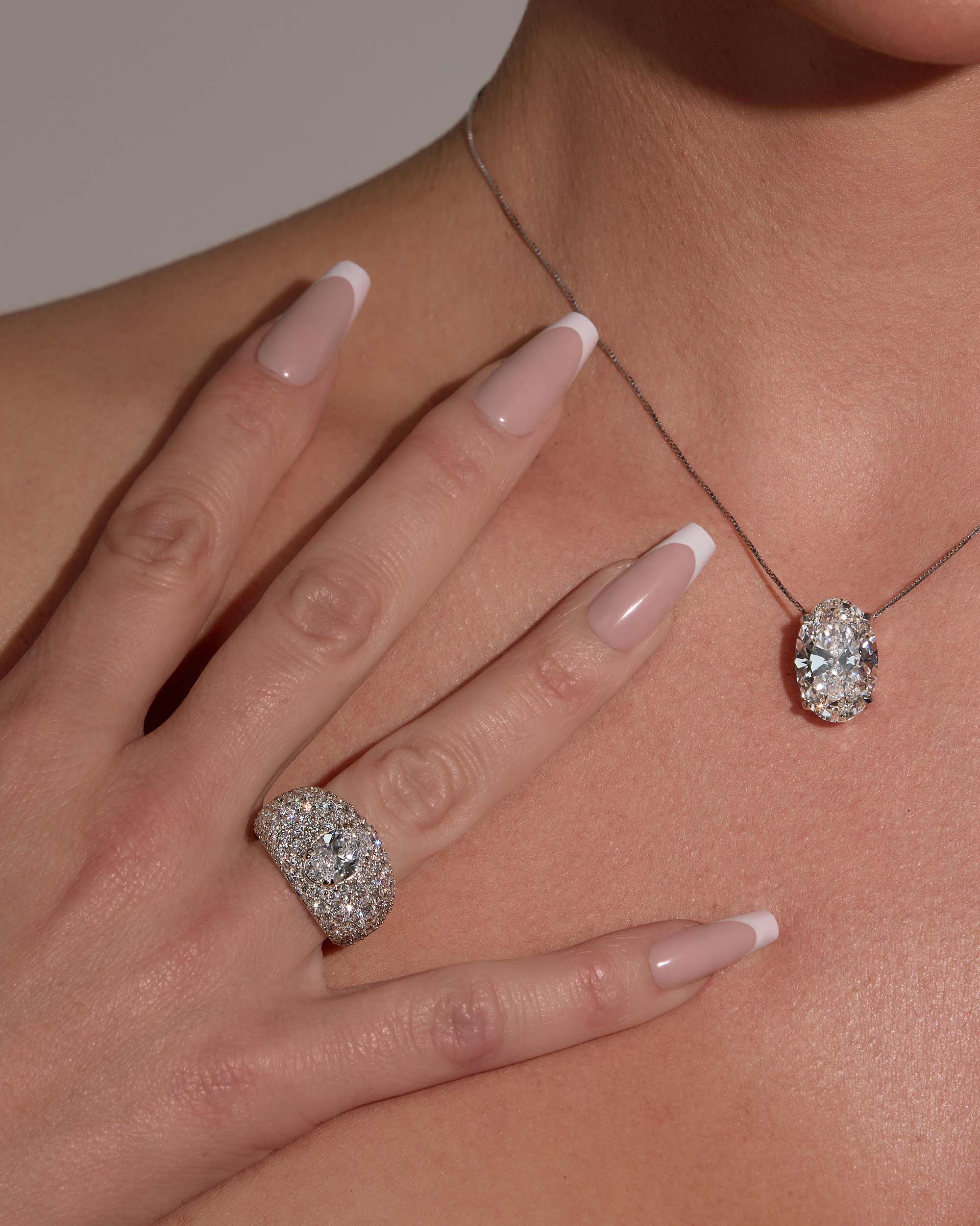 The Bombé Ring